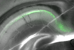 Hirnschnitt aus dem Hippocampus