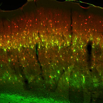 Teile der extrazellulären Matrix (grün), die die Nervenzellen (rot) umgibt, angefärbt und unter dem Mikroskop analysiert