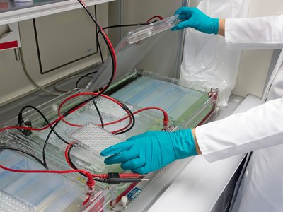 Kittel und Handschuhe einer Person, die im Labor arbeitet