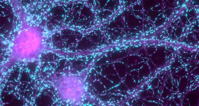 Mikroskopiebild einer Nervenzellen