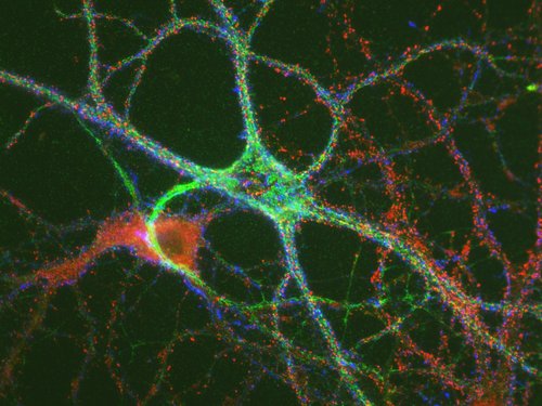 Nervenzelle im Mikroskop
