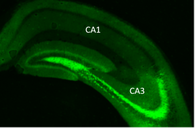 Eingefärbter Hippocampus unter dem Mikroskop