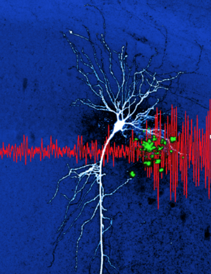 Preprint „Hippocampal hyperactivity in a rat model of Alzheimer’s disease".  Diese Illustration zeigt Amyloidansammlungen (grün) in der Nähe von einer Nervenzelle des Hippokampus (CA1 Pyramidenzelle). Die Ansammlung von Amyloid beta ist ein Prozess, der bei der Alzheimer Erkrankung beobachtet wird. In mehreren Arbeiten unseres Labors (Sosulina et al. bioRxiv 2020, Siskova et al. Neuron 2014) haben wir Pathomechanismen der veränderten Nervenzellerregbarkeit  beschrieben. Diese Veränderungen zeigen sich auf Netzwerkebene durch unregelmäßigere Oszillationen (hier im lokalen Feldpotenzial, rot). 