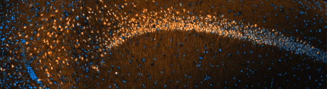 Nervenzellen im Mikroskop