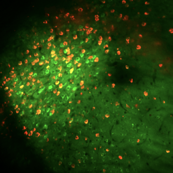 Spezifische Darstellungen von neuronalen Populationen im Subiculum. Alle subikulären Neurone exprimieren den Kalziumsensor GCamP6s, während eine Subpopulation, die ihre Axone in eine spezifische Mittelhirnregion aussendet, durch ein rot fluoreszierendes Protein markiert wird.  