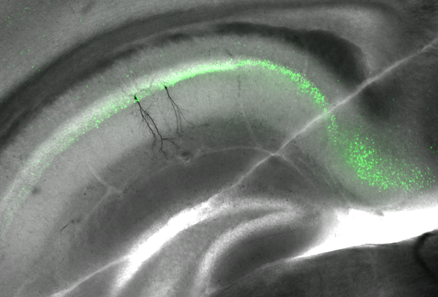 ein Mikroskopiebild eines Schnittes vom Hippocampus, der grün eingefärbt ist