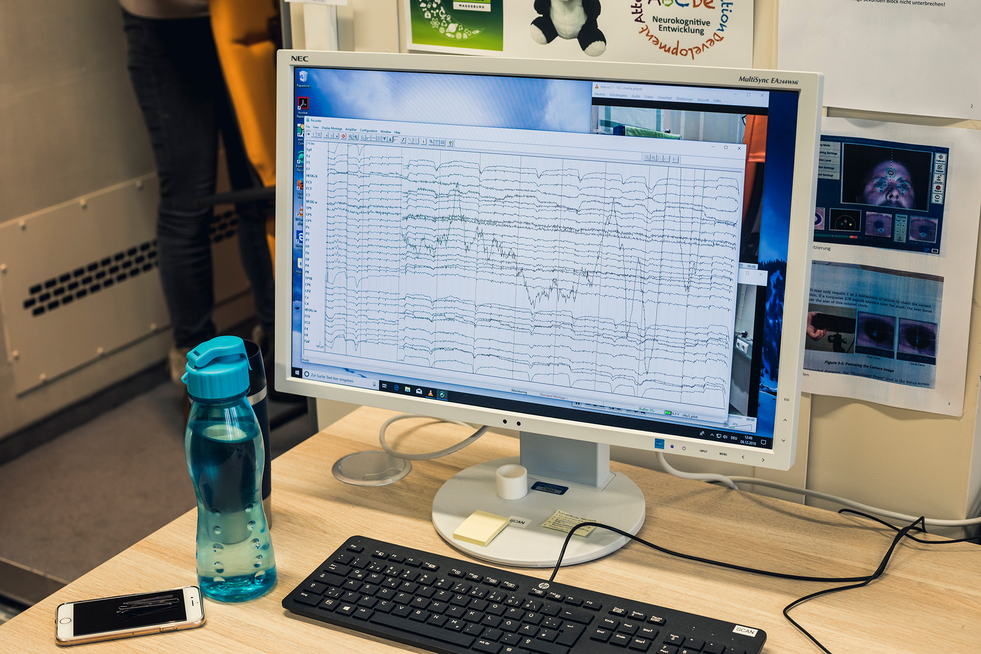 EEG-Auswertung auf einem Computermonitor