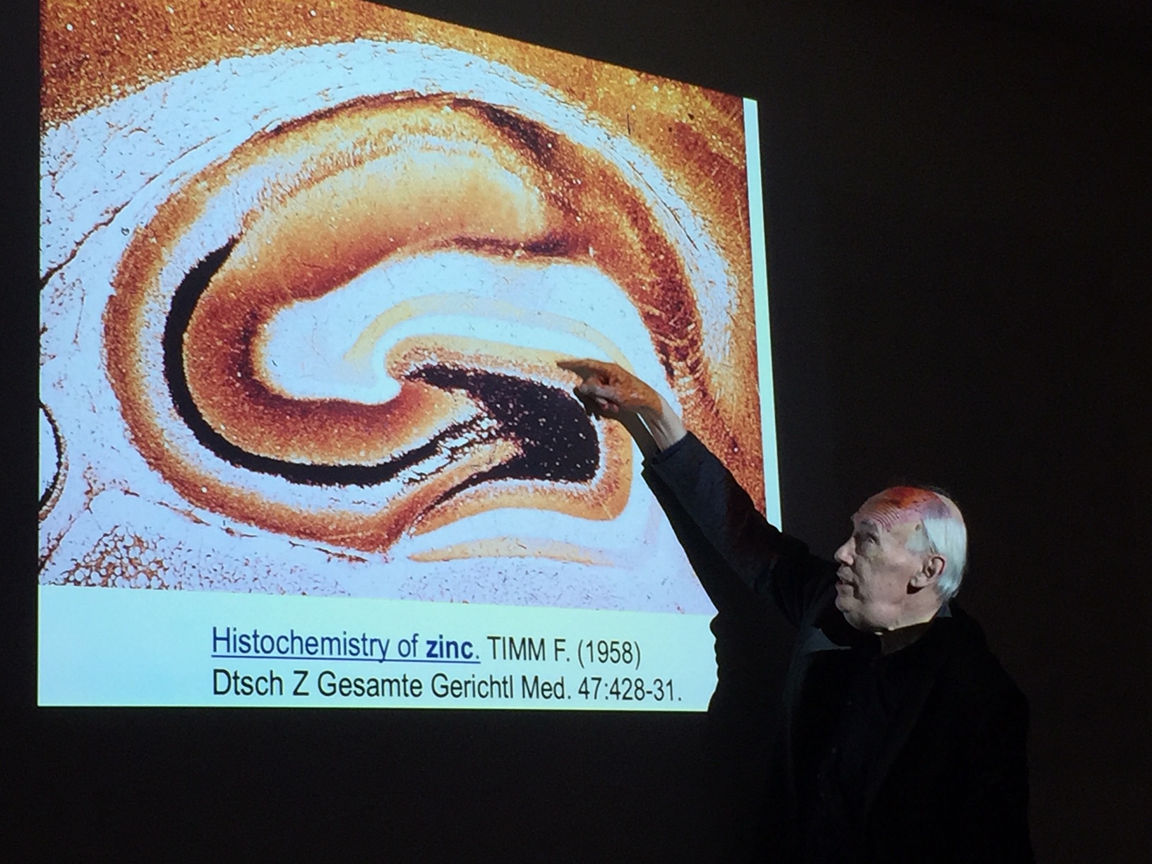 Tim Bliss erklärt Hippocampus-Mikroskopiebild