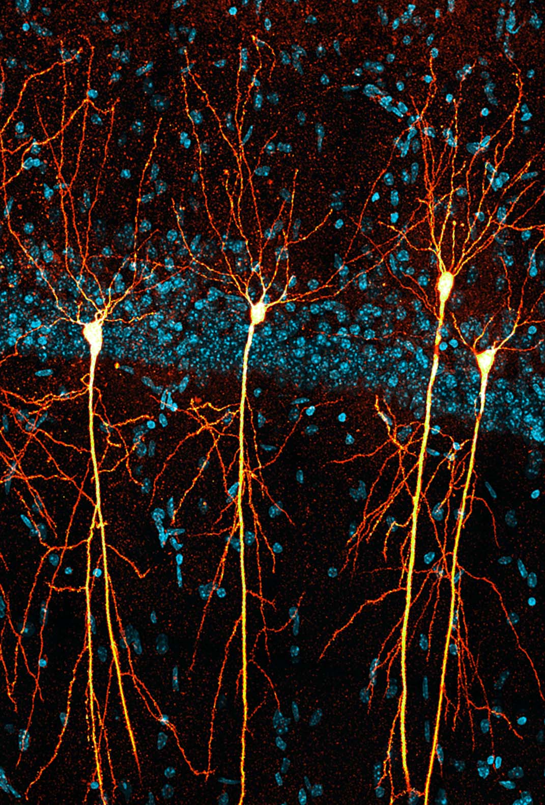 Neurone des Hippocampus unter dem Mikroskop